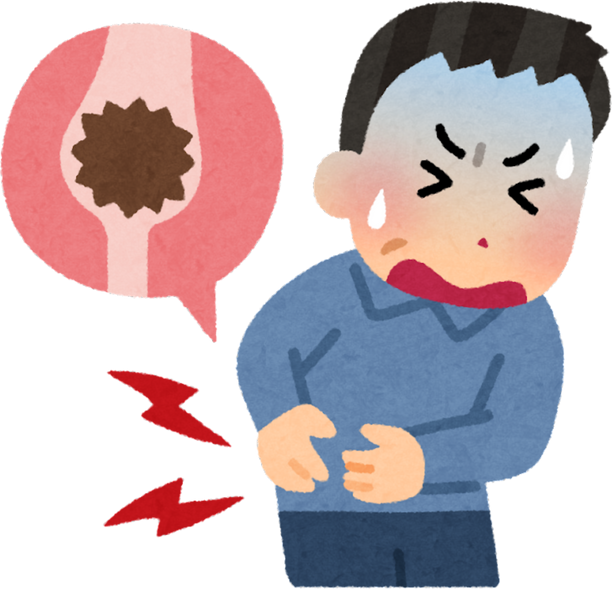 Illustration of a Man Suffering from Kidney Stones